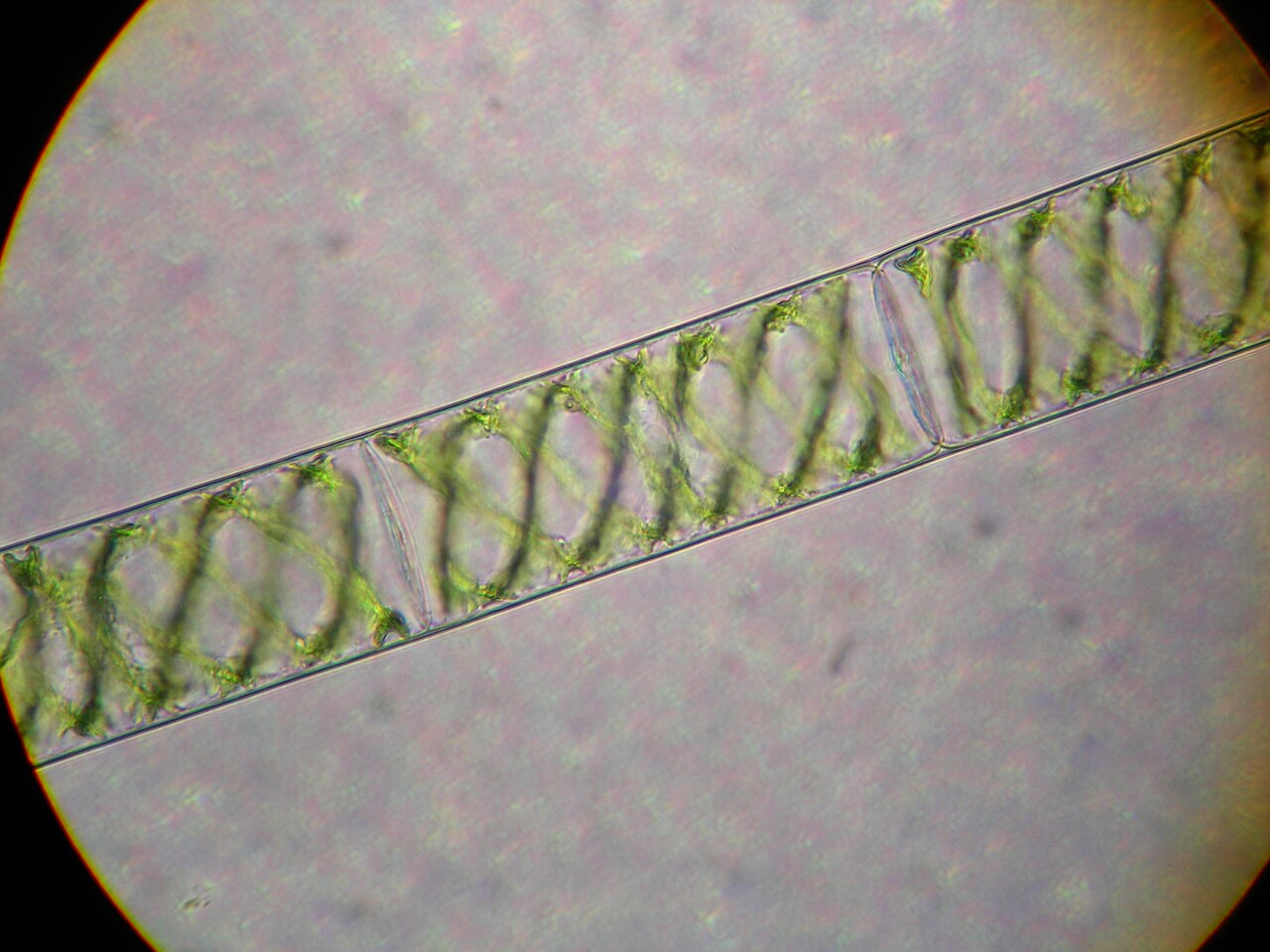 Microscopic Spirogyra filaments showing cell boundaries and spiral green chloroplasts.